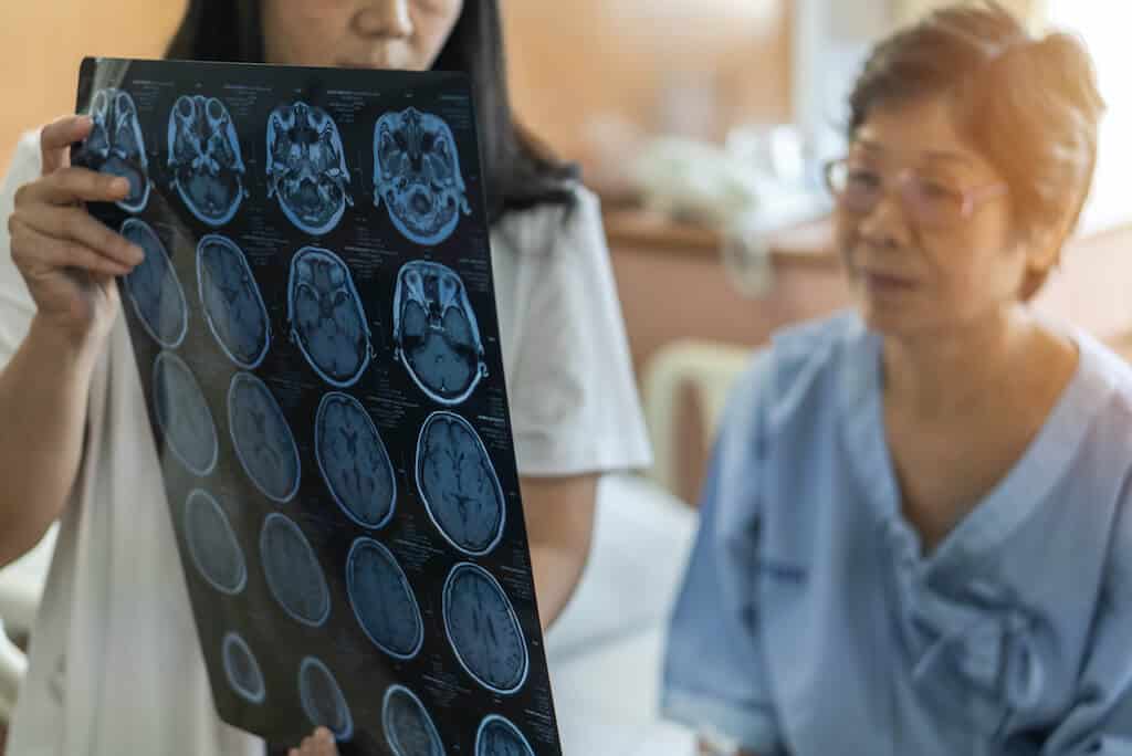 aphasia_research Aphasia Research